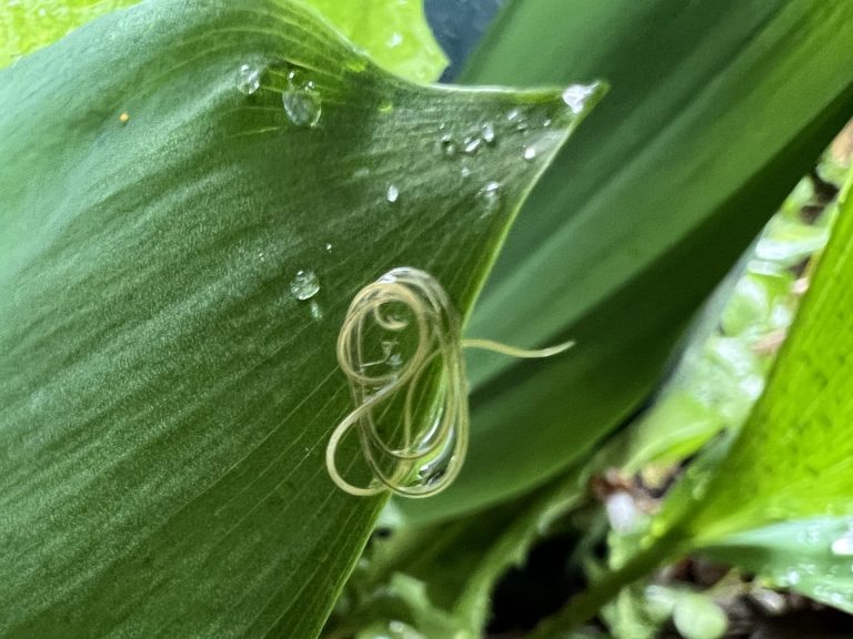 Three-Inch Live Worm Removed From Woman's Brain For The First Time Ever, Doctors Say